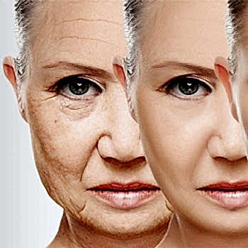Anti Aging